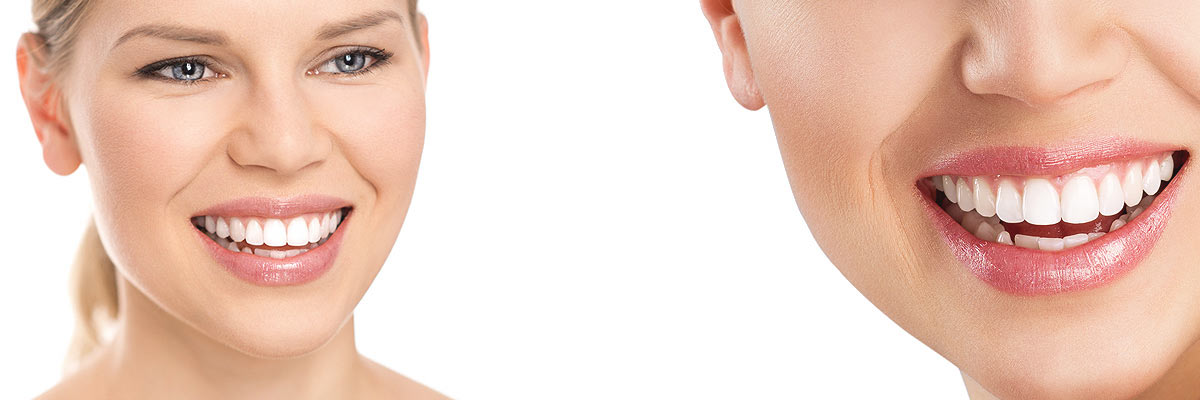 Weatherford Cosmetic Dental Care