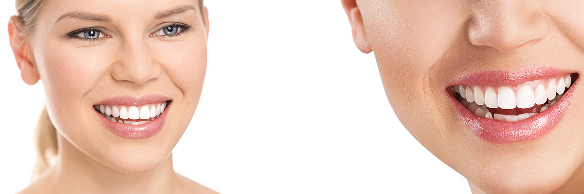 Weatherford Cosmetic Dental Services