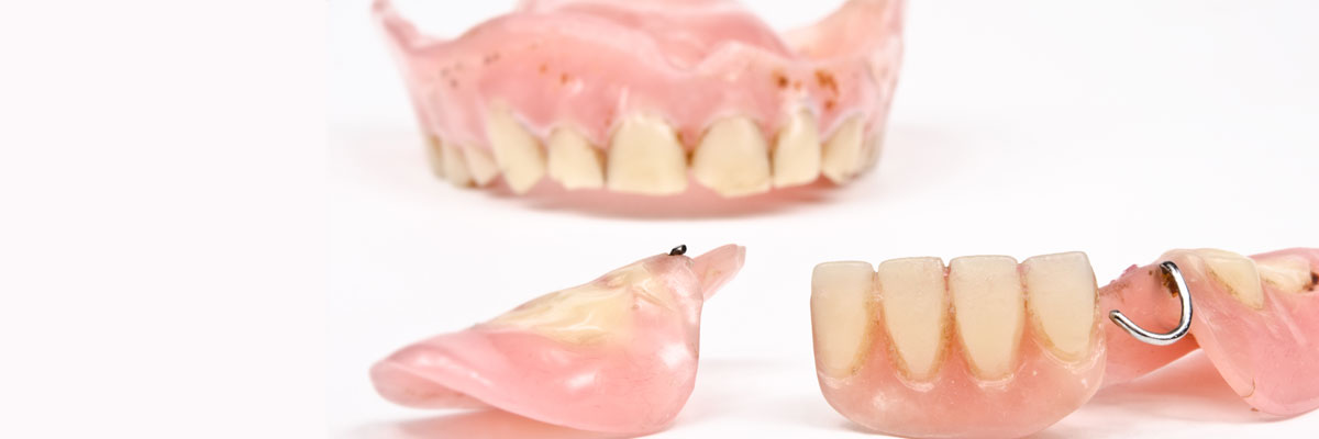 Weatherford What Do I Do If I Damage My Dentures?