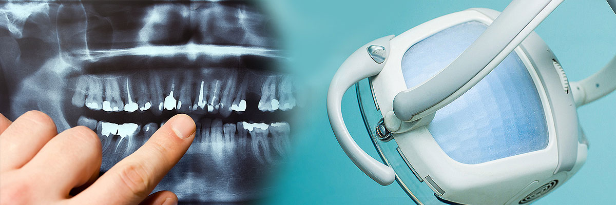 Weatherford Dental Cleaning