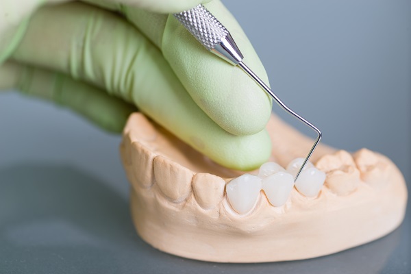 A Dentist Goes Over What You Need To Know About Getting A Dental Crown