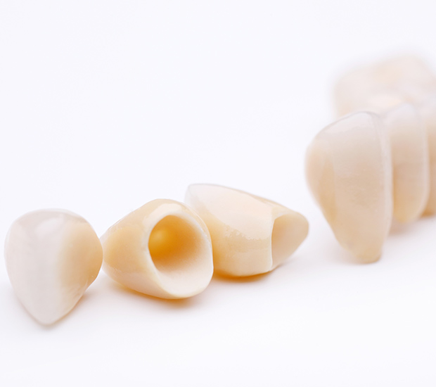 Weatherford Dental Crowns and Dental Bridges