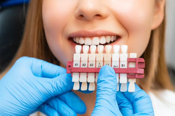 How Dental Veneers Can Boost Your Confidence