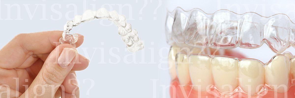 Weatherford Does Invisalign® Really Work?