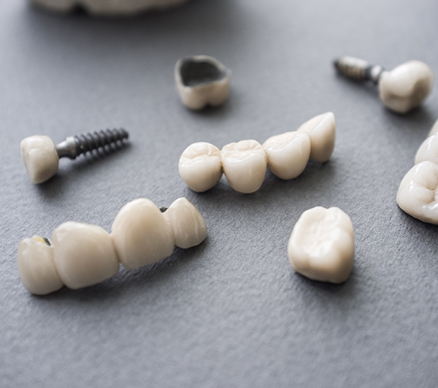 Weatherford The Difference Between Dental Implants and Mini Dental Implants