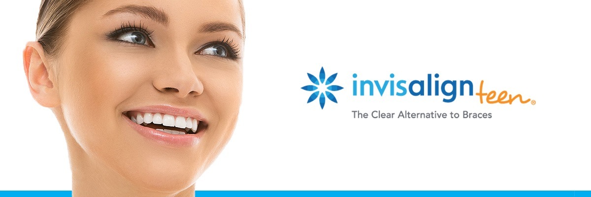 Weatherford Invisalign vs Traditional Braces