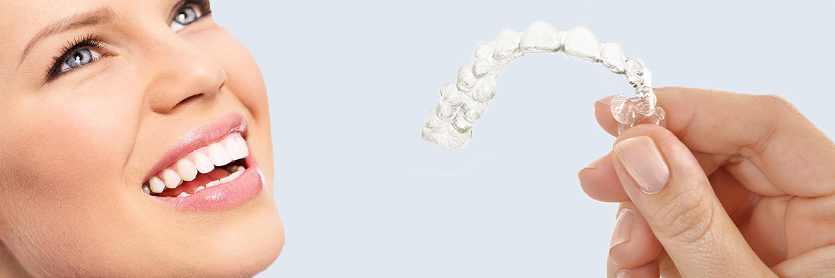 Weatherford 7 Things Parents Need to Know About Invisalign Teen
