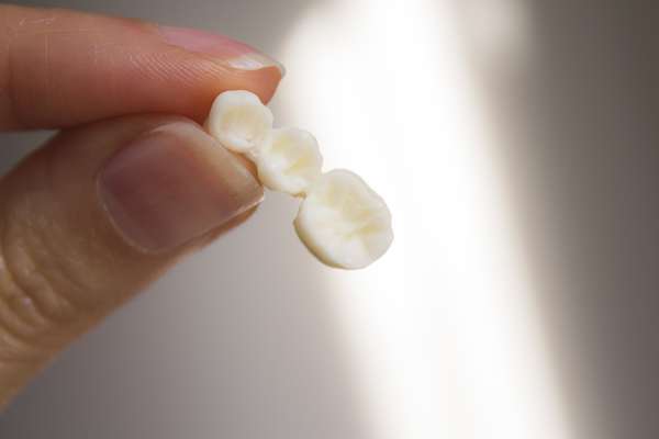 Replace Missing Teeth With Dental Bridges