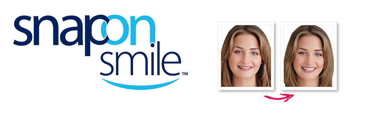 Weatherford Snap-On Smile