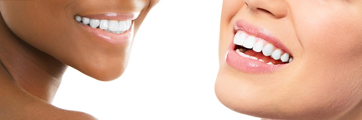 Weatherford Teeth Whitening