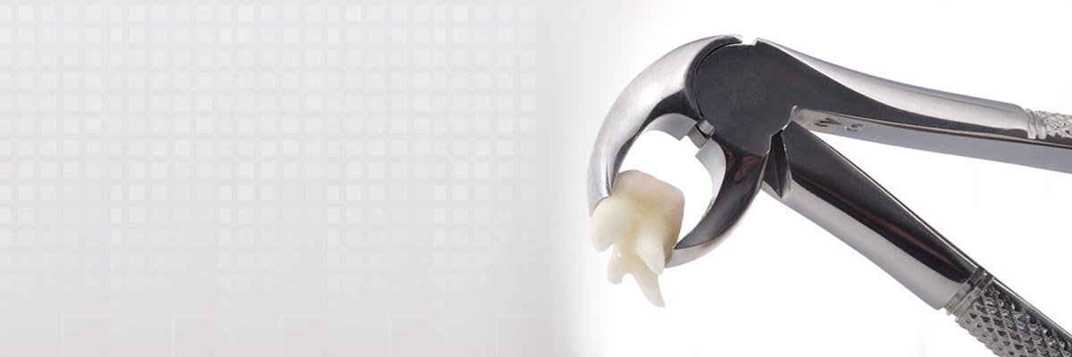 Weatherford Tooth Extraction