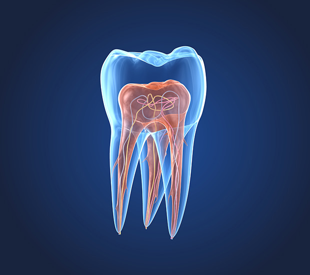 Weatherford What is an Endodontist