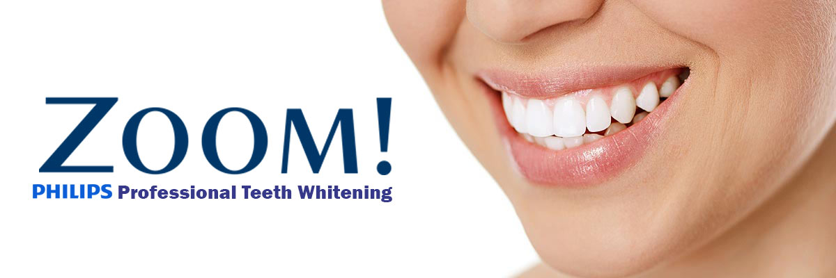 Weatherford Zoom Teeth Whitening